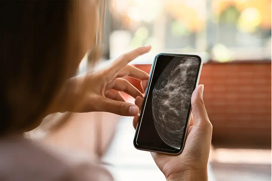 Moça observa o resultado da mamografia em seu próprio celular, conforme imagem com ótima resolução disponibilizada pela Transduson, a partir de seu laboratório em Carapicuíba.